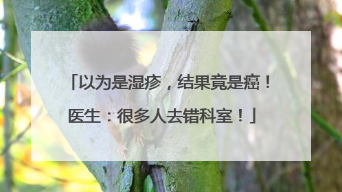 以为是湿疹，结果竟是癌！医生：很多人去错科室！