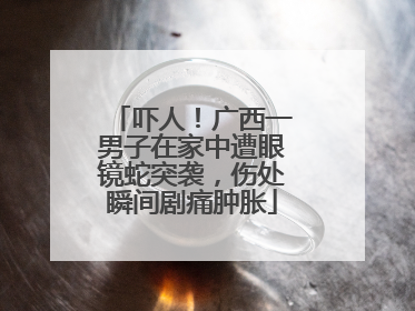 吓人！广西一男子在家中遭眼镜蛇突袭，伤处瞬间剧痛肿胀